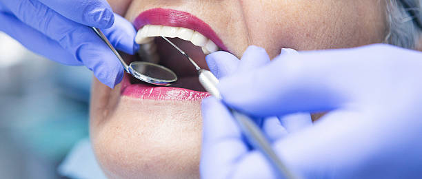 Best Emergency Root Canal Treatment in Follansbee, WV